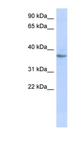 OR10X1 antibody LS-C102791 Western blot of Fetal Muscle lysate.