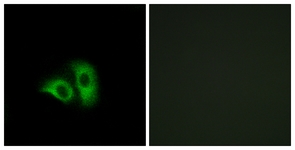 Immunofluorescence of A549 cells, using OR10X1 Antibody. The picture on the right is treated with the synthesized peptide.