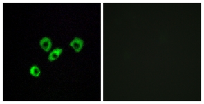 Immunofluorescence of MCF7 cells, using OR10Z1 Antibody. The picture on the right is treated with the synthesized peptide.