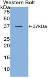 Western blot of recombinant MEP1A.