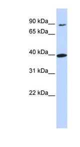 OR11H12 antibody LS-C102125 Western blot of 721_B cell lysate.