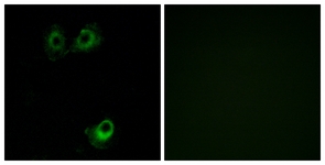Immunofluorescence of A549 cells, using OR11L1 Antibody. The picture on the right is treated with the synthesized peptide.