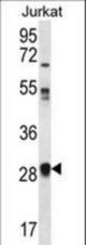 OR11L1 Antibody western blot of Jurkat cell line lysates (35 ug/lane). The OR11L1 antibody detected the OR11L1 protein (arrow).