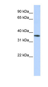 OR13C5 antibody LS-C101346 Western blot of Fetal Liver lysate.