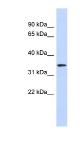OR13C5 antibody LS-C109723 Western blot of Placenta lysate.