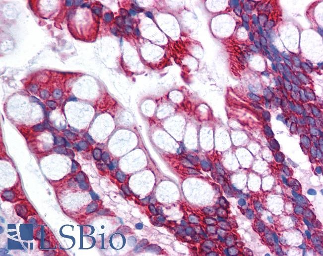 Anti-OR13C9 antibody IHC of human small intestine. Immunohistochemistry of formalin-fixed, paraffin-embedded tissue after heat-induced antigen retrieval. Antibody LS-B989 concentration 5 ug/ml.