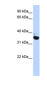 OR13C9 antibody LS-C101376 Western blot of Fetal Heart lysate.