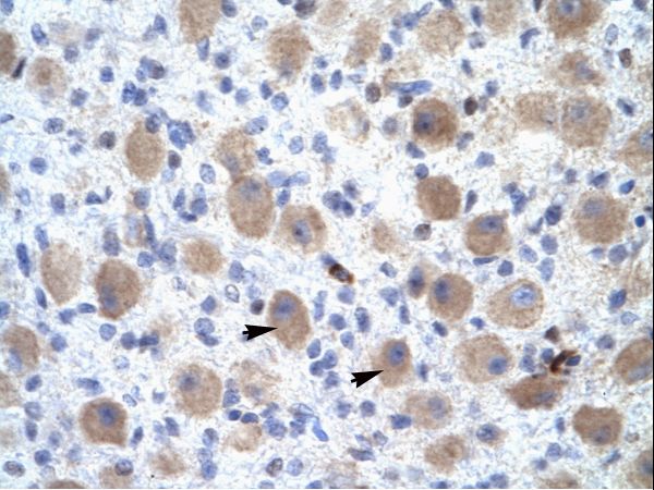 OR13C9 antibody LS-C30762 was used in IHC to stain formalin-fixed, paraffin-embedded human brain.