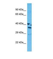 Western blot of Human MCF7. OR13J1 antibody dilution 1.0 ug/ml.