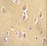 OR13J1 antibody immunohistochemistry of formalin-fixed and paraffin-embedded human brain tissue followed by peroxidase-conjugated secondary antibody and DAB staining.
