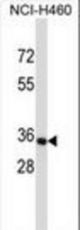 OR14C36 Antibody western blot of NCI-H460 cell line lysates (35 ug/lane). The OR14C36 antibody detected the OR14C36 protein (arrow).