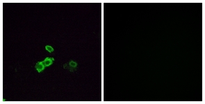 Immunofluorescence of MCF7 cells, using OR5U1 Antibody. The picture on the right is treated with the synthesized peptide.
