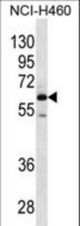 MEPE Antibody western blot of NCI-H460 cell line lysates (35 ug/lane). The MEPE antibody detected the MEPE protein (arrow).