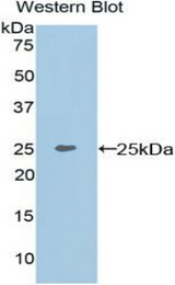 Western blot of recombinant MEPE.