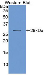 Western blot of recombinant MEPE.