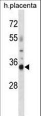 OR4K13 Antibody western blot of human placenta tissue lysates (35 ug/lane). The OR4K13 antibody detected the OR4K13 protein (arrow).