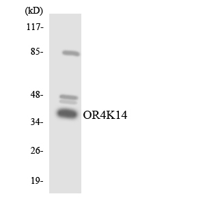 Western blot of the lysates from COLO205 cells using OR4K14 antibody.