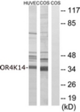 Western blot of extracts from COS7/HUVEC cells, using OR4K14 Antibody. The lane on the right is treated with the synthesized peptide.