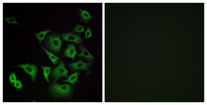 Immunofluorescence of A549 cells, using OR4K14 Antibody. The picture on the right is treated with the synthesized peptide.