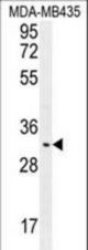 OR4K2 Antibody western blot of MDA-MB435 cell line lysates (35 ug/lane). The OR4K2 antibody detected the OR4K2 protein (arrow).