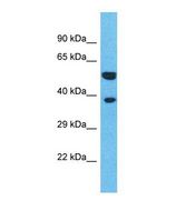 Western blot of Human HeLa. OR4L1 antibody dilution 1.0 ug/ml.