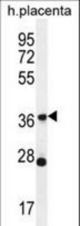 OR4L1 Antibody western blot of human placenta tissue lysates (35 ug/lane). The OR4L1 antibody detected the OR4L1 protein (arrow).