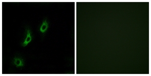 Immunofluorescence of COS7 cells, using OR4L1 Antibody. The picture on the right is treated with the synthesized peptide.