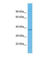 Western blot of Human 721_B. OR4M1 antibody dilution 1.0 ug/ml.