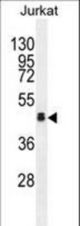 OR4N4 Antibody western blot of Jurkat cell line lysates (35 ug/lane). The OR4N4 antibody detected the OR4N4 protein (arrow).