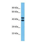 Western blot of Human MCF7. OR4Q3 antibody dilution 1.0 ug/ml.