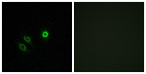 Immunofluorescence of A549 cells, using OR4X1 Antibody. The picture on the right is treated with the synthesized peptide.