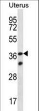 OR4X2 Antibody western blot of human normal Uterus tissue lysates (35 ug/lane). The OR4X2 antibody detected the OR4X2 protein (arrow).