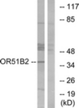 Western blot of extracts from HT-29 cells, using OR51B2 Antibody. The lane on the right is treated with the synthesized peptide.