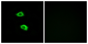 Immunofluorescence of LOVO cells, using OR51B5 Antibody. The picture on the right is treated with the synthesized peptide.