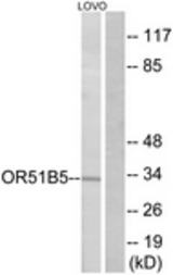 Western blot of extracts from LOVO cells, using OR51B5 Antibody. The lane on the right is treated with the synthesized peptide.