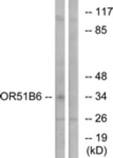 Western blot of extracts from K562 cells, using OR51B6 Antibody. The lane on the right was incubated with synthetic peptide.