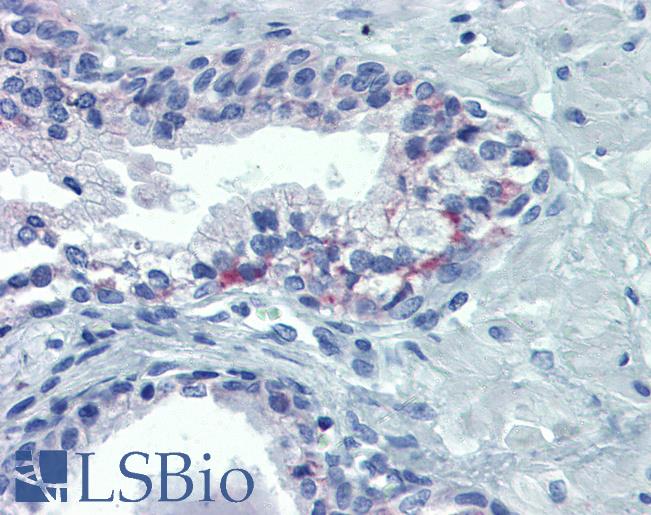 Anti-OR51E1 antibody IHC of human prostate. Immunohistochemistry of formalin-fixed, paraffin-embedded tissue after heat-induced antigen retrieval. Antibody LS-B4084 concentration 20 ug/ml.