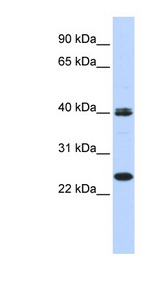 MESP1 antibody LS-C101757 Western blot of 293T cell lysate.