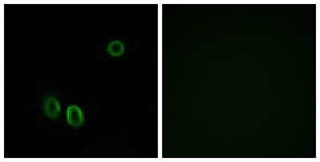Immunofluorescence of A549 cells, using OR51E1 Antibody. The picture on the right is treated with the synthesized peptide.