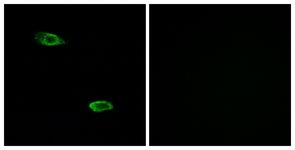 Immunofluorescence of A549 cells, using OR51E2 Antibody. The picture on the right is treated with the synthesized peptide.