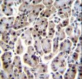 MESP1 Antibody immunohistochemistry of formalin-fixed and paraffin-embedded human pancreas tissue followed by peroxidase-conjugated secondary antibody and DAB staining.