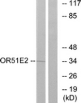 Western blot of extracts from Jurkat cells, using OR51E2 Antibody. The lane on the right is treated with the synthesized peptide.