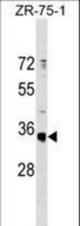 OR51G1 Antibody western blot of ZR-75-1 cell line lysates (35 ug/lane). The OR51G1 Antibody detected the OR51G1 protein (arrow).