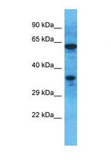 Western blot of Human Jurkat. OR51M1 antibody dilution 1.0 ug/ml.