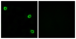 Immunofluorescence of LOVO cells, using OR51Q1 Antibody. The sample on the right was incubated with synthetic peptide.