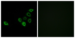 Immunofluorescence of A549 cells, using OR51S1 Antibody. The picture on the right is treated with the synthesized peptide.