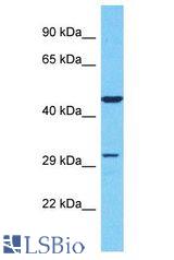 OR51S1 antibody Western Blot of Jurkat. Antibody dilution: 1 ug/ml.