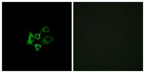 Immunofluorescence of A549 cells, using OR51T1 Antibody. The picture on the right is treated with the synthesized peptide.