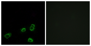 Immunofluorescence of MCF7 cells, using OR52A1 Antibody. The picture on the right is treated with the synthesized peptide.