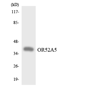 Western blot of the lysates from HepG2 cells using OR52A5 antibody.